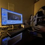 Análisis de organoides por micróscopo confocal