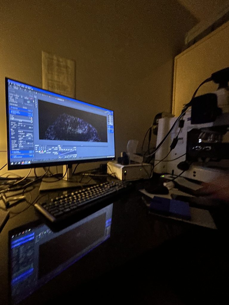 Análisis de organoides por micróscopo confocal